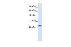 VPS24 Antibody, Novus Biologicals 100 &mu;L; Unconjugated:Antibodies, Polyclonal